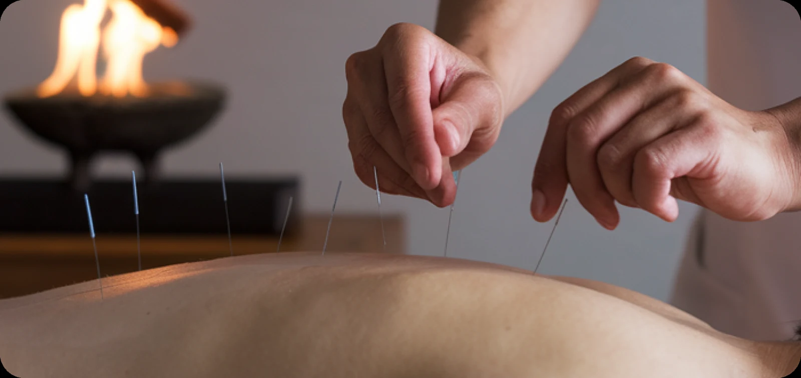 Acupuncture massage simulation